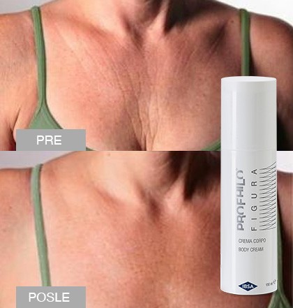 figura-pre-i-posle.jpg