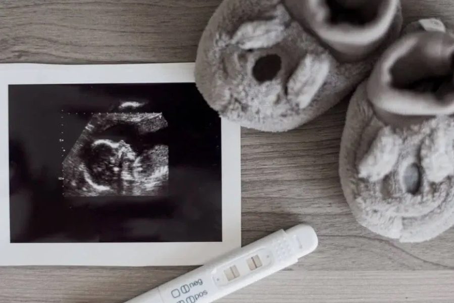 Pripreme za trudnoću - na šta treba da pripazite