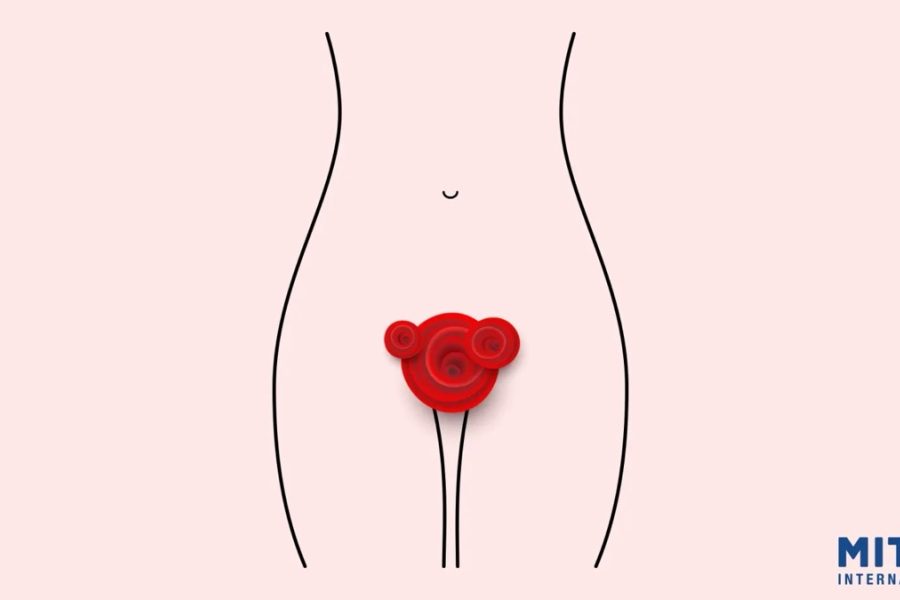 Vaginalno krvarenje van ciklusa