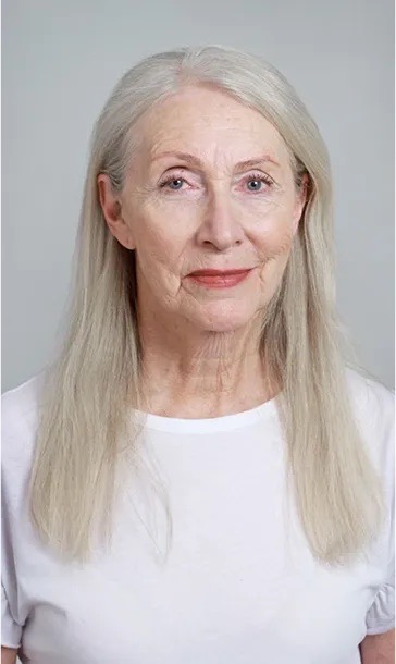 Dunjina priča: Skrivena hipotireoza