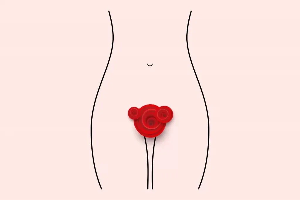 Vaginalno krvarenje van ciklusa
