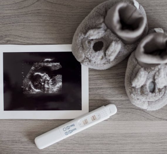 Pripreme za trudnoću – na šta treba da pripazite