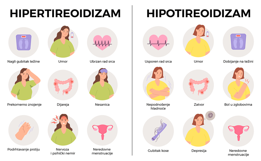 Oblici hipertireoidizma i hipotireoidizma.